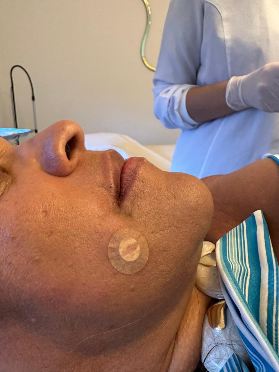 Preenchimento Facial São José dos Campos | Flor de Lis