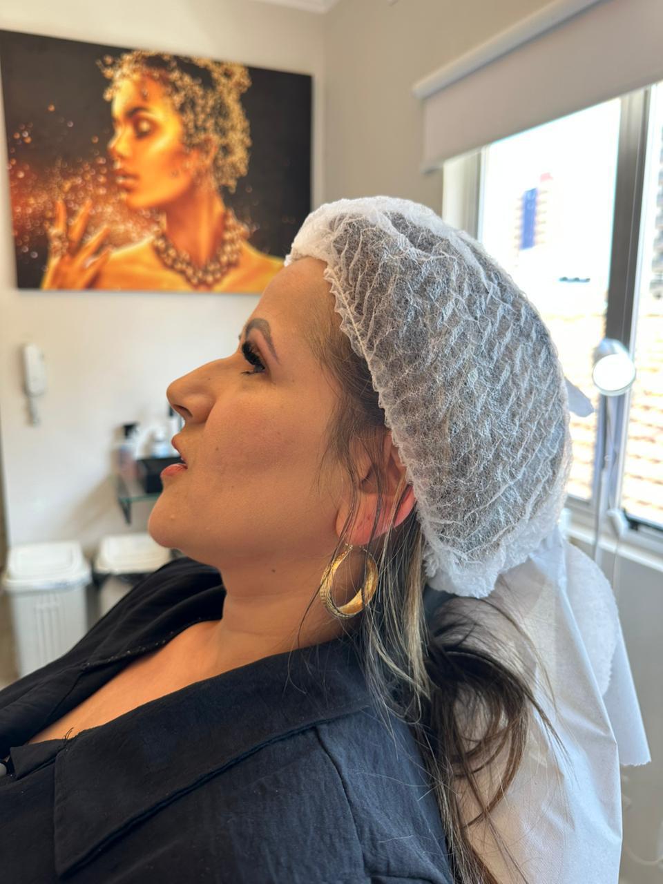 Preenchimento Facial São José dos Campos | Flor de Lis